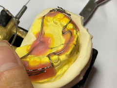 Специально изготовленное ортодонтическое устройство с хорошим удержанием и регулируемыми функциями