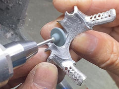 Частичный протез