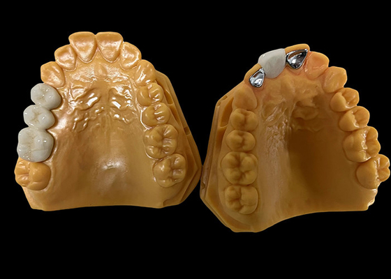 Купить Порцелан средней прозрачности, сплавленный с металлом, PFM Crown, PFM Ceramic Crown online manufacture