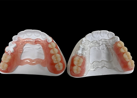 Купить Частичная зубная протез, зубной протез для жевания и речи. online manufacture
