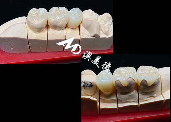 Купить OEM Precision Fit Ceramic Inlays Onlays для долговечных и натуральных зубных реставраций с превосходной прочностью и надежностью online manufacture