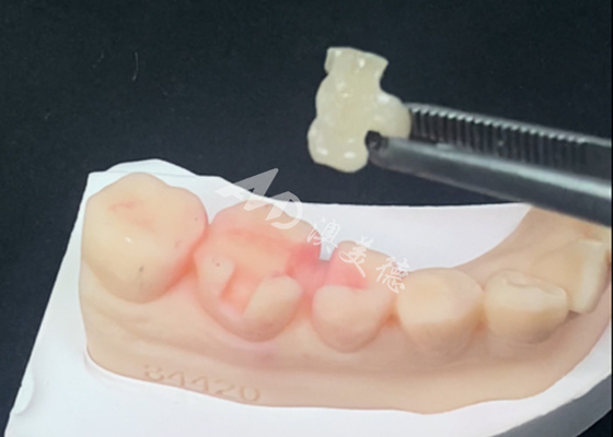 Купить Emax Керамические вкладыши Вкладыши зубные реставрации для естественного цвета зубов и легкого обслуживания online manufacture