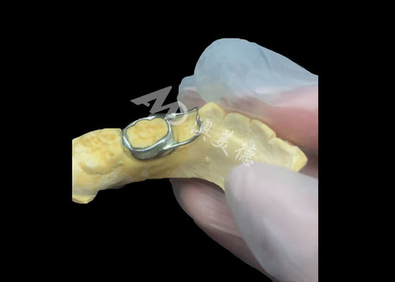Купить Ортодонтический поддерживающий пространство - бесценное устройство, гениально охраняющее промежутки зубов детей, обеспечивающее правильное развитие зубов. online manufacture