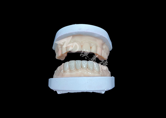 Купить IPS Emax Veneers Восстановление естественного вида для эстетической улыбки online manufacture
