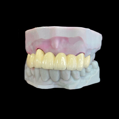 Купить Порцелановая корона, расплавленная в металл (PFM) с рамкой Co-Cr online manufacture