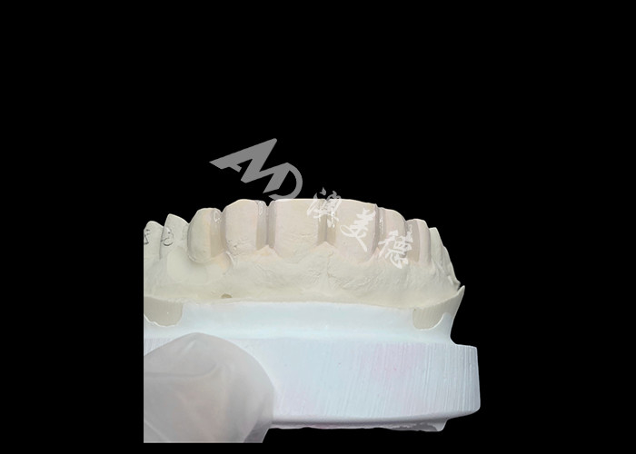 IPS Emax Veneers Minimal Prep/ No-prep Veneers являются инновационными решениями для красивой улыбки