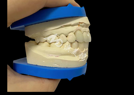 Хорошая цена Непревзойденная прочность зубной цирконии Dentla корона для естественной улыбки онлайн