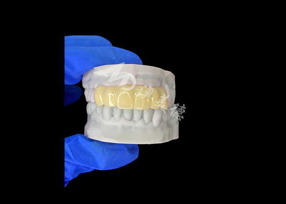 Хорошая цена Легкий биосовместимый 3D печатный полый временный мост для реставрации перед имплантацией онлайн