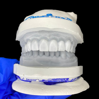 Хорошая цена Diagnostic Wax-Up for Porcelain Veneers онлайн