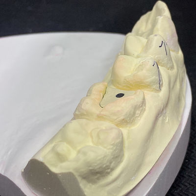 Хорошая цена Укрепите свое восстановление с помощью технологии Lock Pink Post Core онлайн