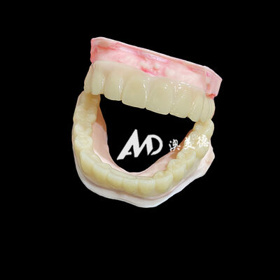 Хорошая цена Lightweight PMMA Temporary Bridges with Hollow Design for Implant Restorations онлайн
