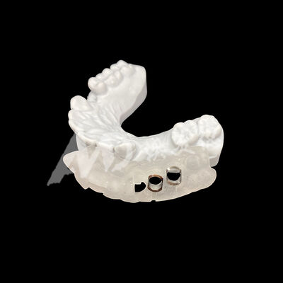 Хорошая цена 3D печатный гид для хирургических имплантатов с высокой устойчивостью к обесцвечиванию с использованием технологии фрезерного производства CAD / CAM онлайн